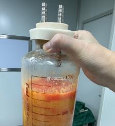 汉川水动力吸脂手术要做多久？